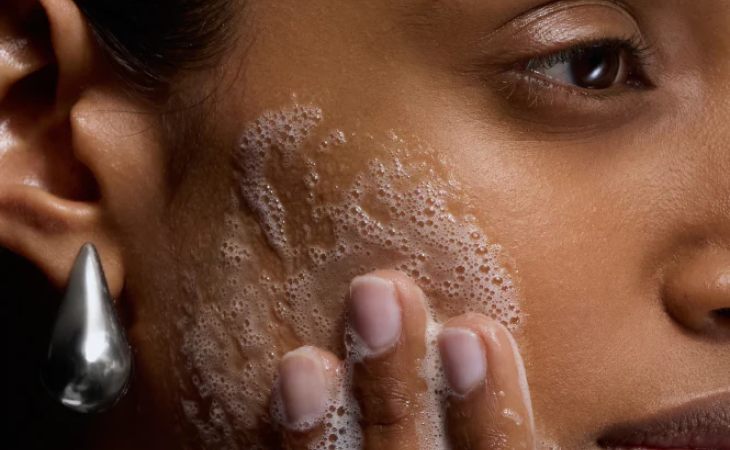 L'acné peau grasse : comprendre, traiter et prévenir.