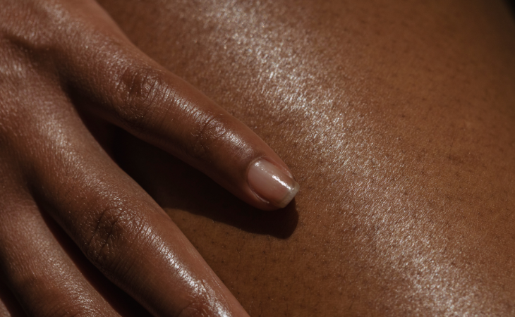 Pourquoi ma peau pèle ? Causes et solutions détaillées